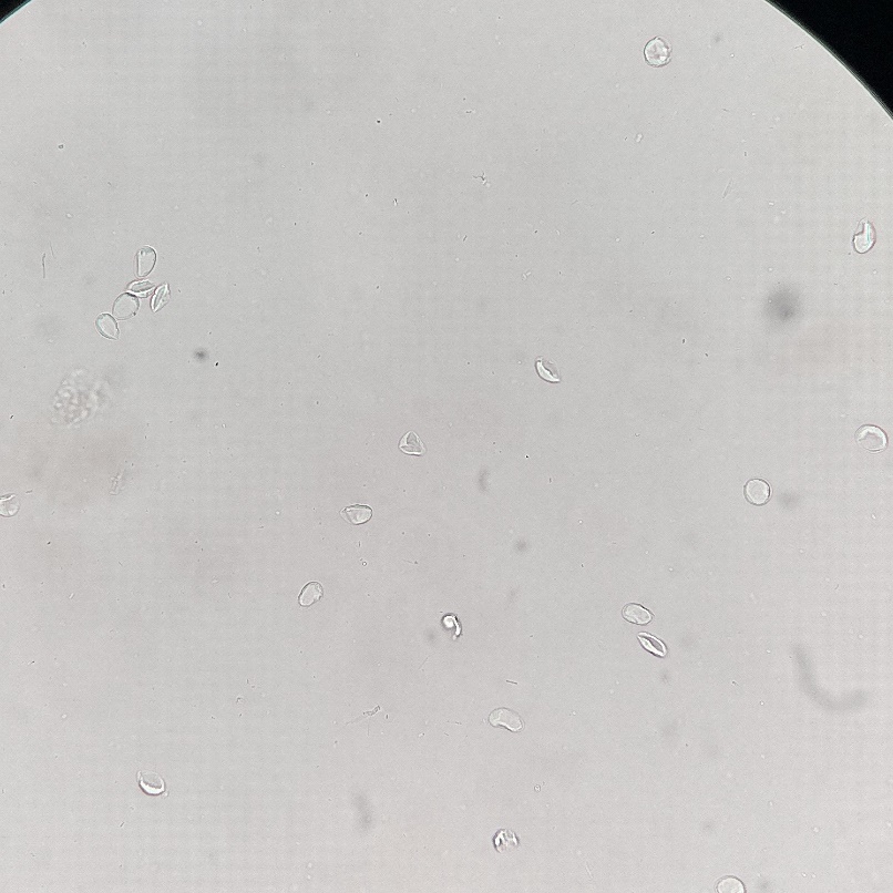 Mikrofotografia Giardia intestinalis uzyskana metodą flotacji, powiększenie 400 razy
